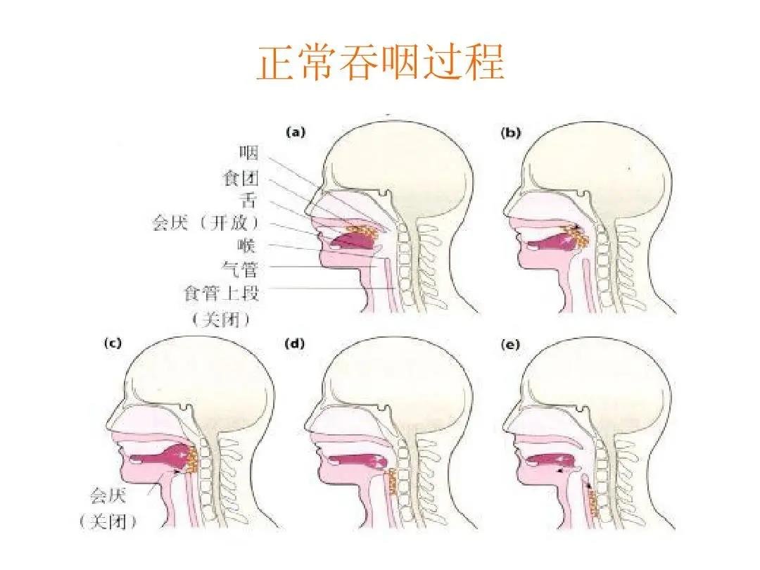 广州市东升医院带您了解吞咽和言语治疗的那些事-医院汇-丁香园